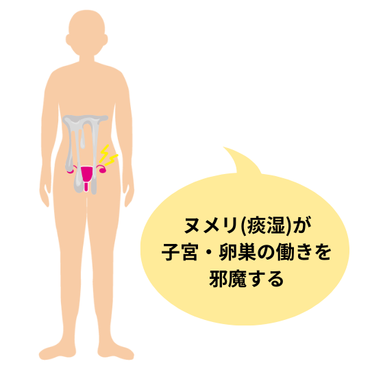 多嚢胞性卵巣症候群と痰湿